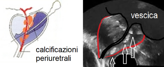 Dimensioni normali della prostata a 60 anni, A prosztata adenoma átkerül a partnerbe