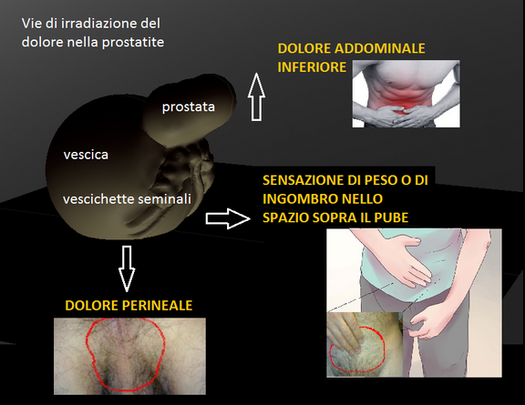 balanita cu prostatita